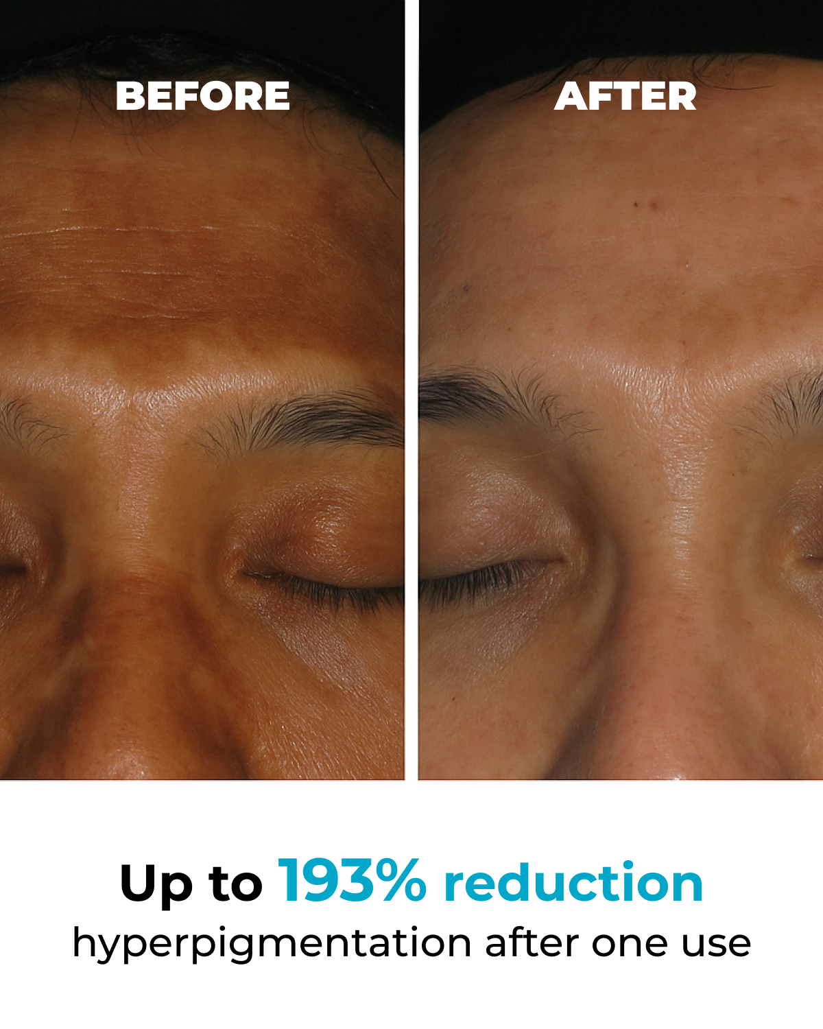 Viral Poción Corporal Viral Jelly Booster para Pigmentación